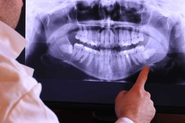 Best Chipped Tooth Repair Near Me  in Edcouch, TX