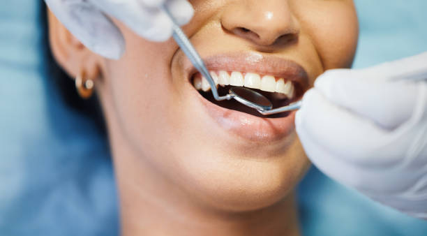 Best Broken Tooth Emergency  in Edcouch, TX